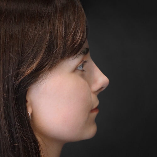 daria-nos-10d-aspect-ratio-500-500