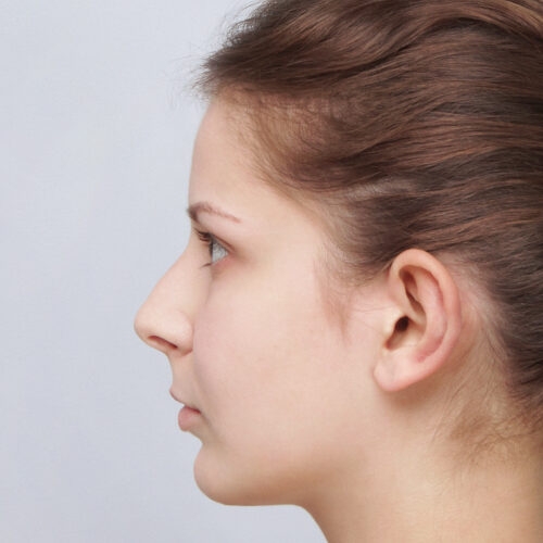 daria-nos-id63145-11c-aspect-ratio-500-500