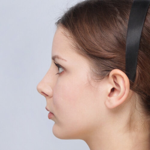 daria-nos-id63145-11d-aspect-ratio-500-500