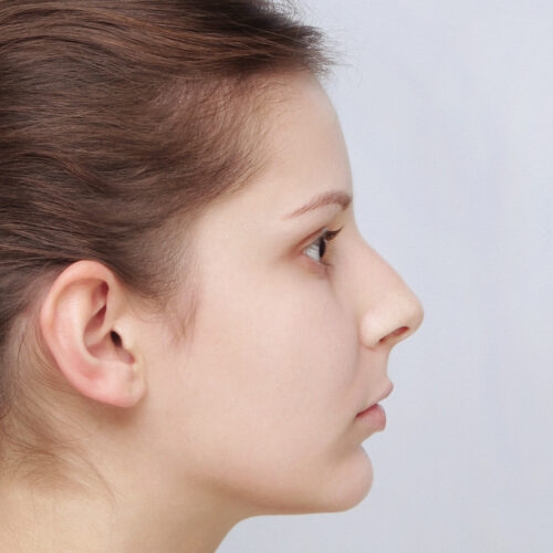 daria-nos-id63145-11e-aspect-ratio-500-500