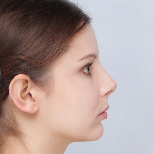 daria-nos-id63145-11f-aspect-ratio-500-500