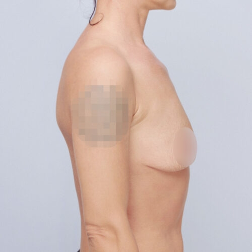 daria-piersi-podn-pow-id60632-5e-aspect-ratio-500-500