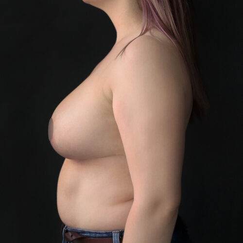 daria-piersi-redukcja-id58832-36f-aspect-ratio-500-500