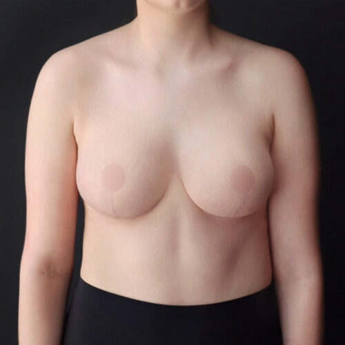 daria-piersi-redukcja-id62318-32b-aspect-ratio-500-500