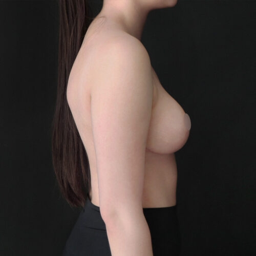 daria-piersi-redukcja-id62318-32d-aspect-ratio-500-500