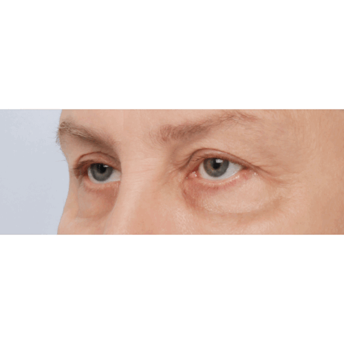 daria2a-58233-aspect-ratio-500-500