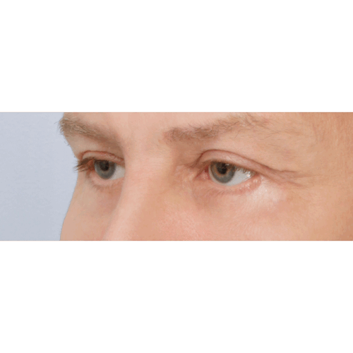 daria2b-58233-aspect-ratio-500-500