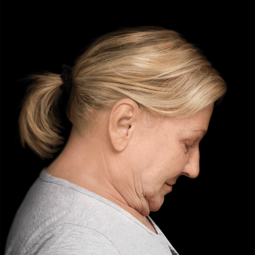 dpfl1c-aspect-ratio-500-500