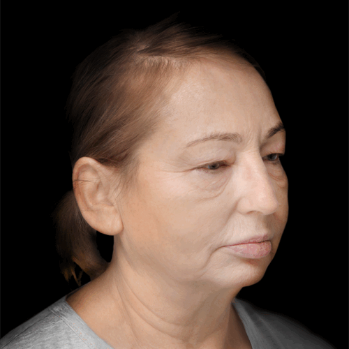 dpfl2c-aspect-ratio-500-500