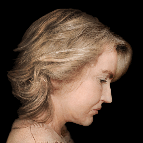 dpfl3d-aspect-ratio-500-500