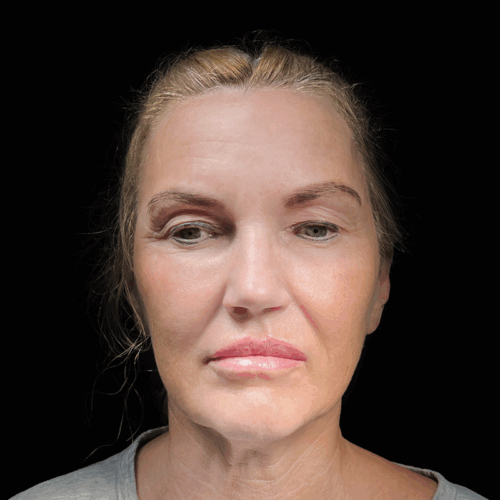 dpfl4a-aspect-ratio-500-500