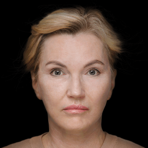 dpfl4b-aspect-ratio-500-500