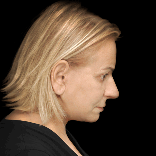 dpfl6b-aspect-ratio-500-500