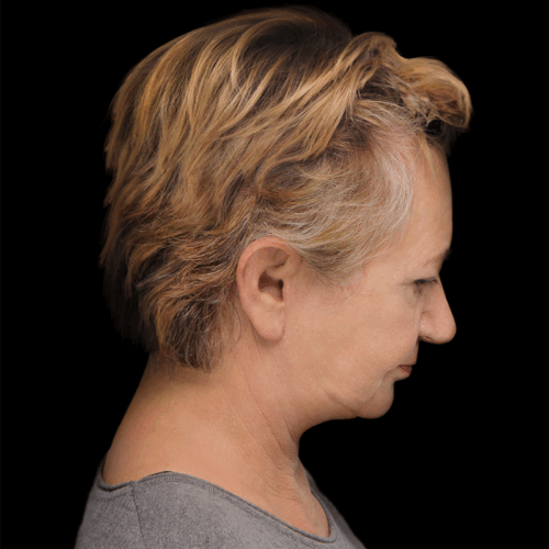 dpfl7b-aspect-ratio-500-500