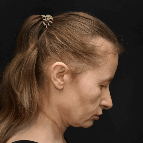 dpfl9a-aspect-ratio-500-500