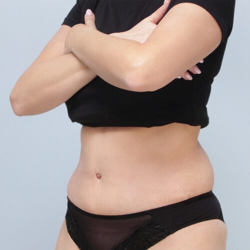 ferenc-brzuch-64104-5d-aspect-ratio-500-500