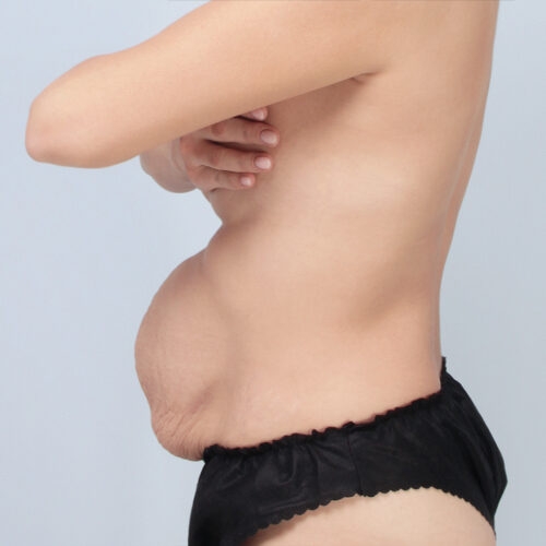 ferenc-brzuch-64104-5e-aspect-ratio-500-500