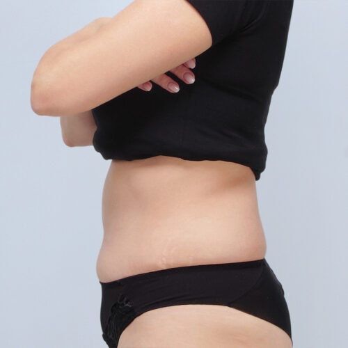 ferenc-brzuch-64104-5f-aspect-ratio-500-500