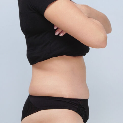 ferenc-brzuch-64104-5h-aspect-ratio-500-500