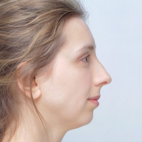 ferenc-nos-id67947-1c-aspect-ratio-500-500