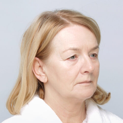 ferenc-powieki-twarz-63608-1a-aspect-ratio-500-500