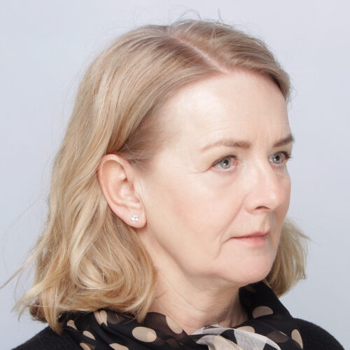 ferenc-powieki-twarz-63608-1c-aspect-ratio-500-500