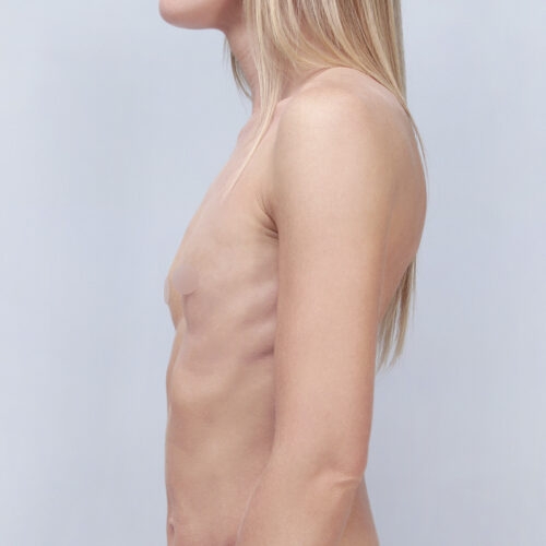 kulesza-implanty-id67698-7a-aspect-ratio-500-500