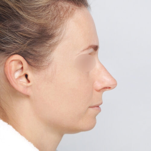 kulicki1a-3-aspect-ratio-500-500