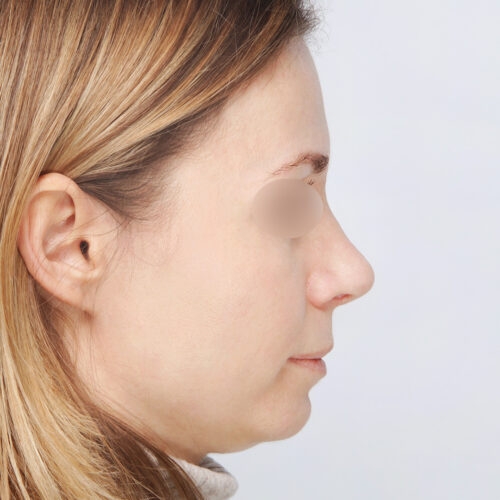 kulicki1b-2-aspect-ratio-500-500