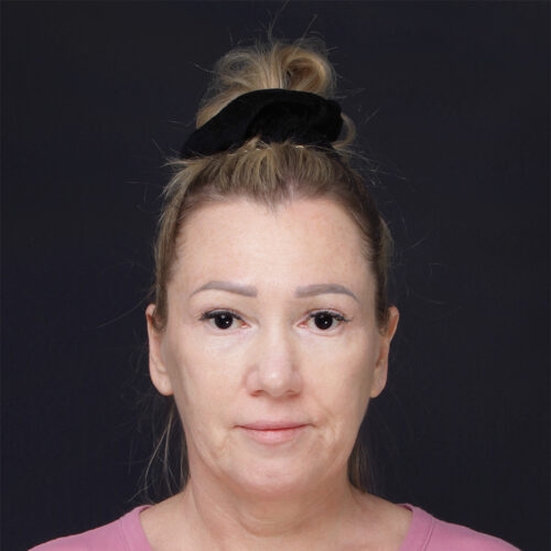 lift-daria-62504-13a-aspect-ratio-500-500