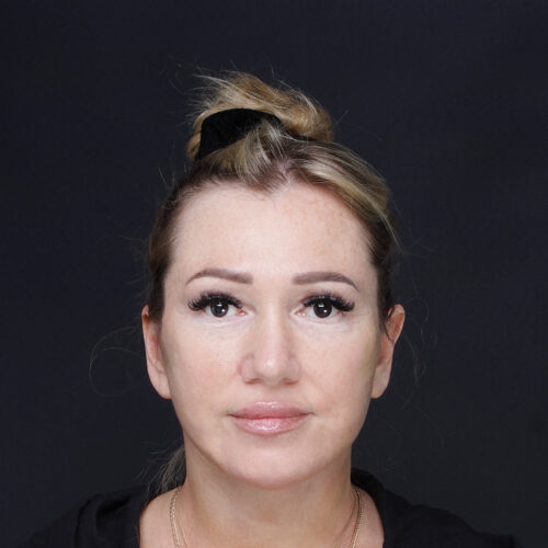 lift-daria-62504-13b-aspect-ratio-500-500