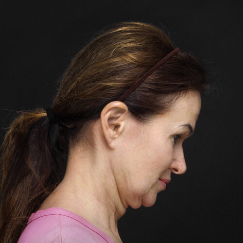 lift-michal-11a-aspect-ratio-500-500