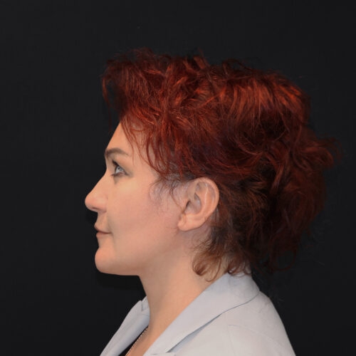 lift-michal-15f-aspect-ratio-500-500