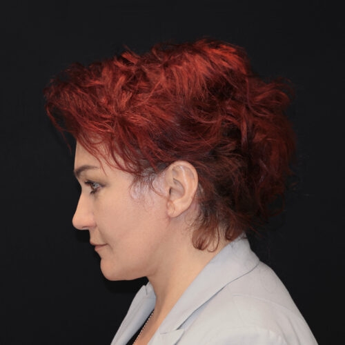 lift-michal-15h-aspect-ratio-500-500