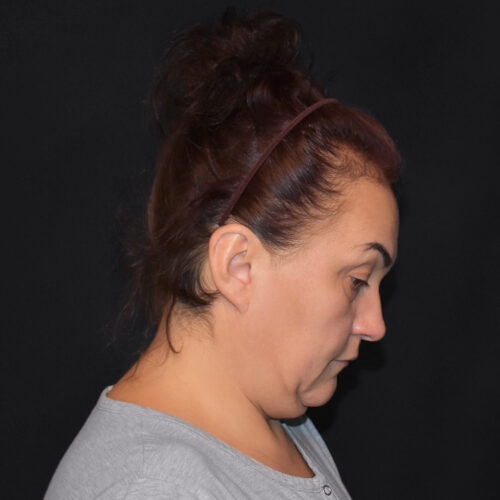 lift-michal-15i-aspect-ratio-500-500