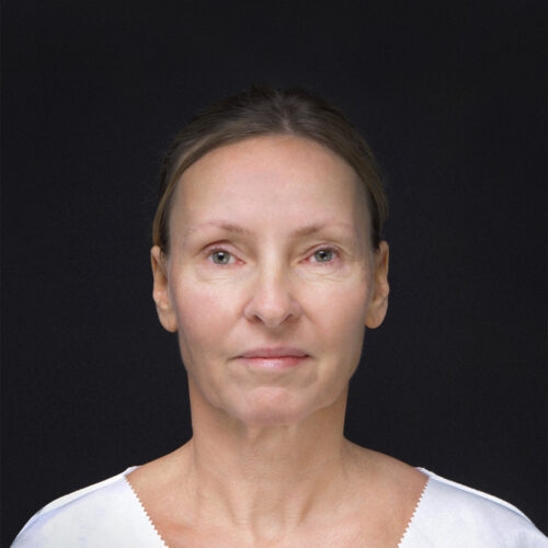 michal-lift-id69265-18a-aspect-ratio-500-500