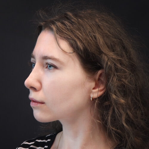 michal-nos-30f-aspect-ratio-500-500