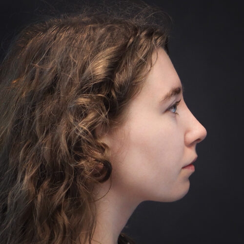 michal-nos-30h-aspect-ratio-500-500