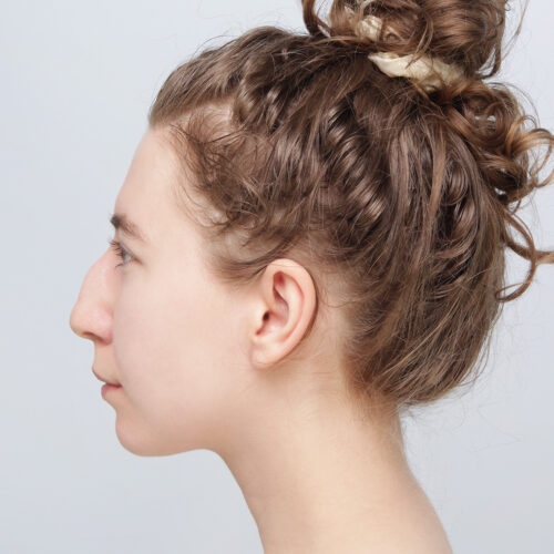 michal-nos-30i-aspect-ratio-500-500