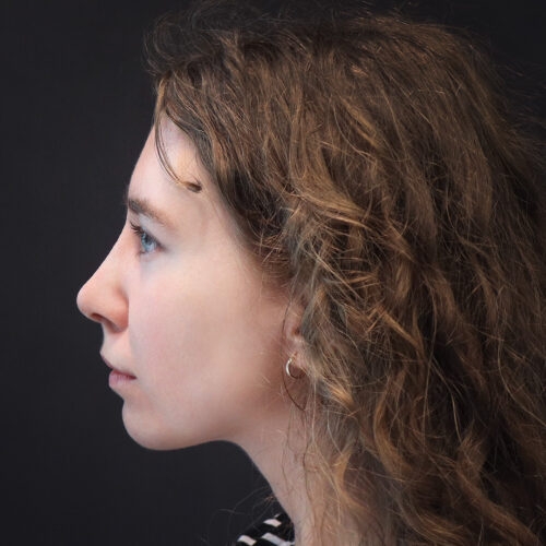 michal-nos-30j-aspect-ratio-500-500