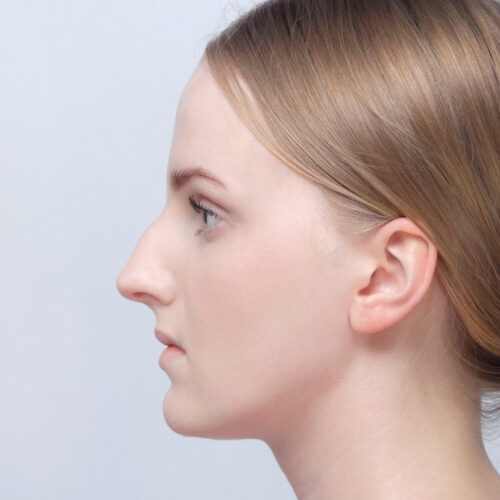 michal-nos-id67820-34c-aspect-ratio-500-500