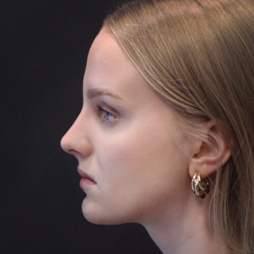 michal-nos-id67820-34d-aspect-ratio-500-500