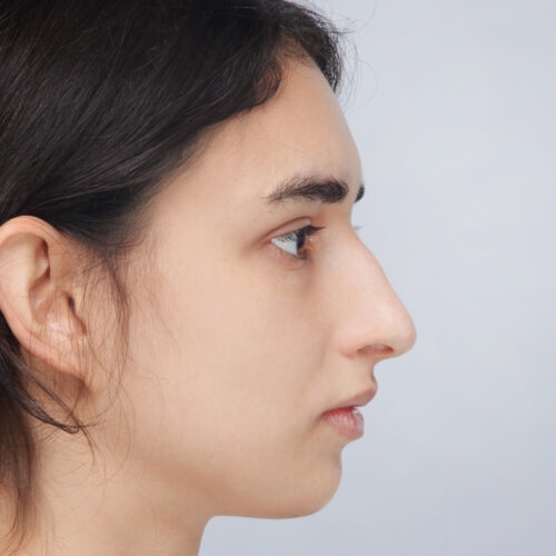 michal11a-aspect-ratio-500-500