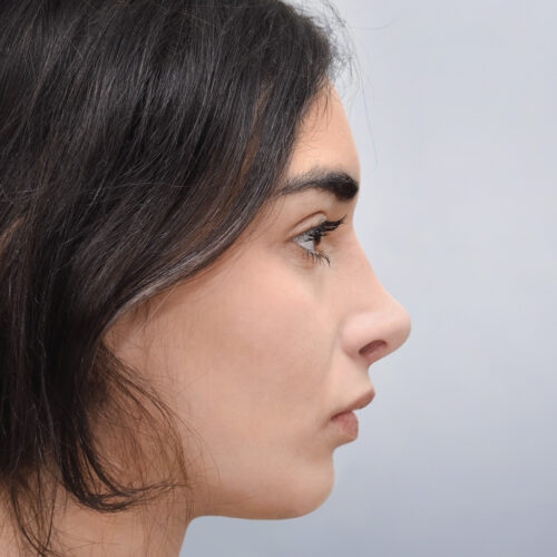 michal11b-aspect-ratio-500-500