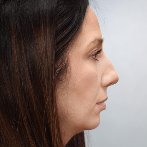 michal12a-aspect-ratio-500-500