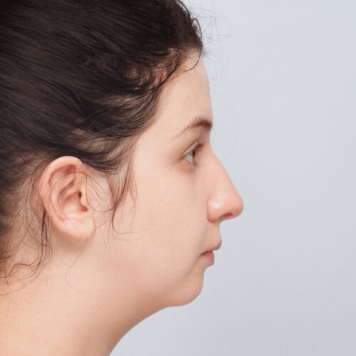 michal13a-aspect-ratio-500-500