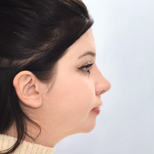 michal13b-aspect-ratio-500-500