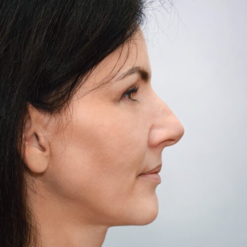 michal16a-aspect-ratio-500-500