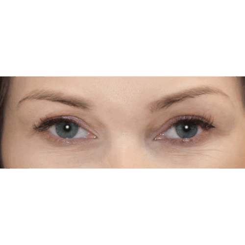 michal1a-2-aspect-ratio-500-500