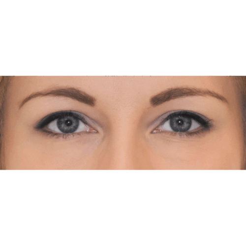 michal1b-aspect-ratio-500-500